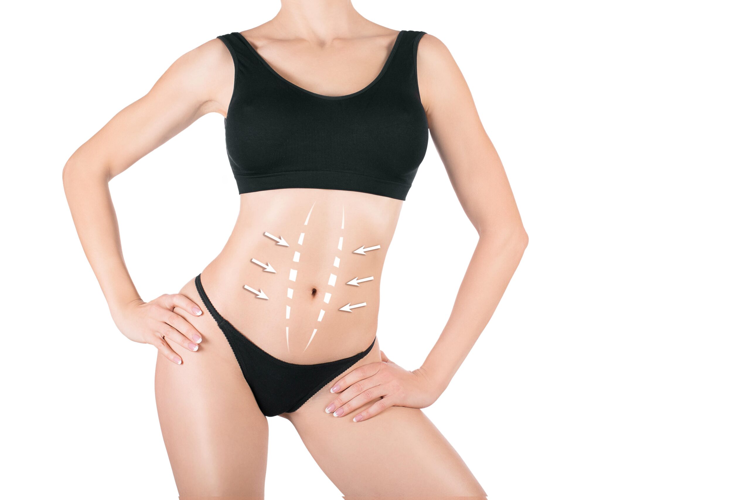 Female attractive body tummy tuck